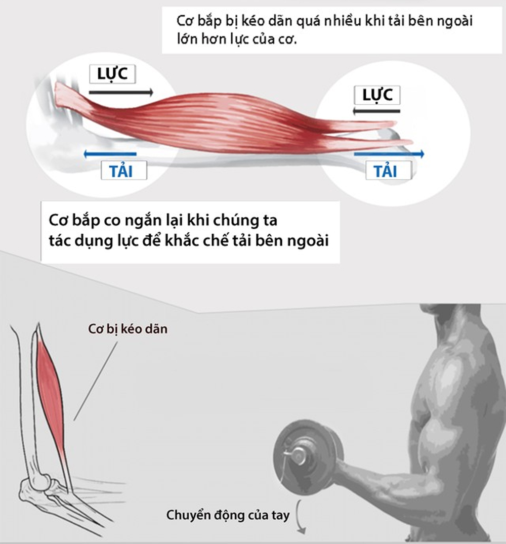 Đau Cơ Sau Khi Tập Gym: Nguyên Nhân, Cách Giảm Đau Và Những Lưu Ý Quan Trọng